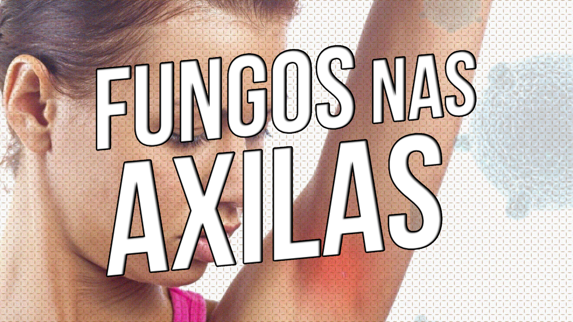 Fungos nas axilas: Descubra como se livrar desse problema de forma rápida e eficaz