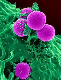 Neutrófilo (verde) ingerindo bactérias Staphylococcus aureus (roxo)