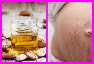 Óleo de amêndoas para estrias: a solução natural para uma pele lisinha