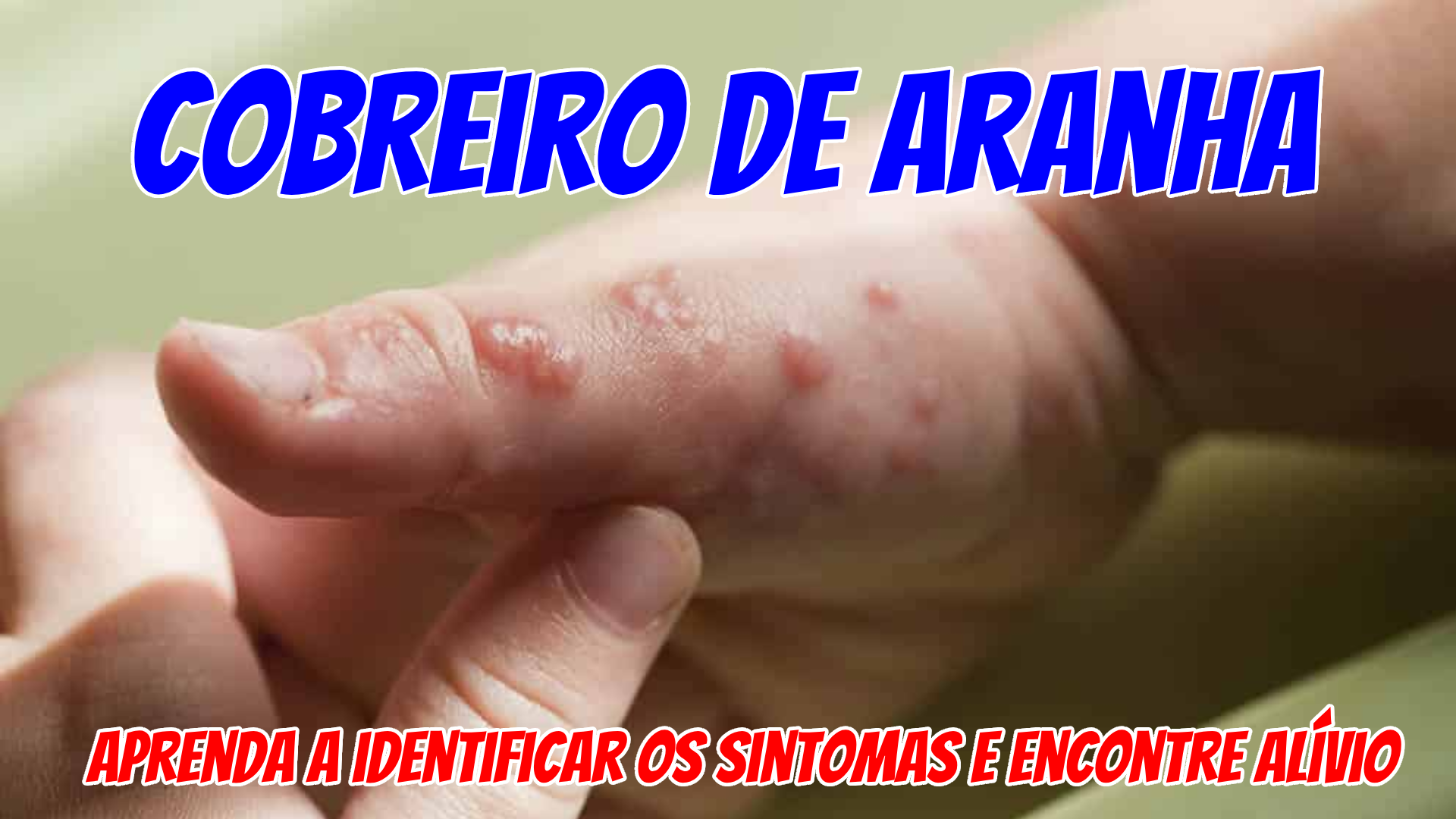 Cobreiro de aranha - Aprenda a identificar os sintomas e encontre alívio